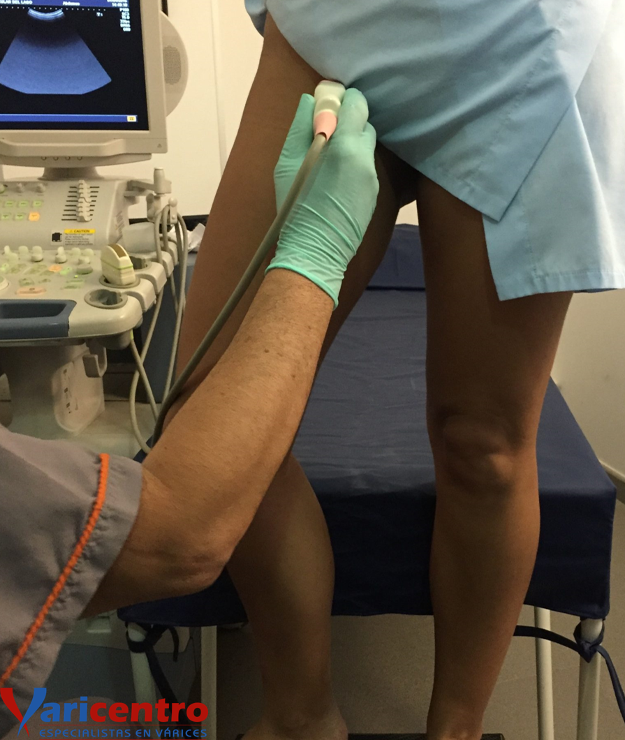 Ecografía doppler venosa de miembros inferiores